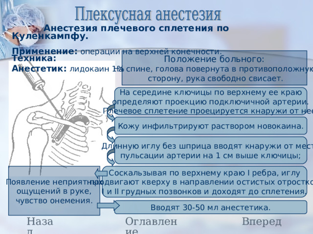 Местная Анестезия